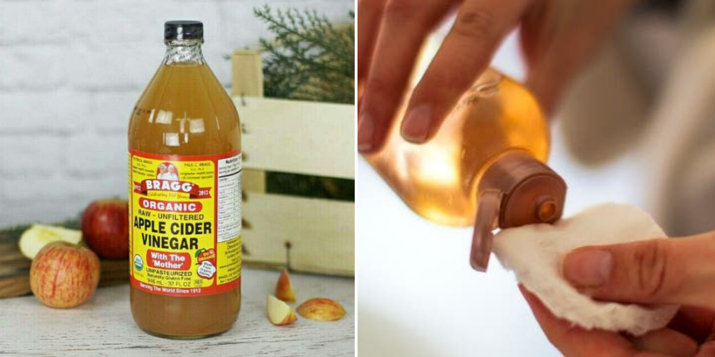 home remedies for acne scars - apple cider vinegar